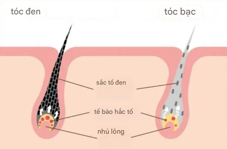 Tóc bạc trắng, liệu có thể đen lại được không? Giải đáp chi tiết đây!