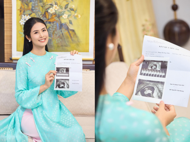 "Tử cung lạnh" là bệnh gì mà Hoa hậu Ngọc Hân bị nên khó khăn khi mang thai