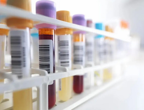 4 chỉ số xét nghiệm máu rất quan trọng, bạn đã biết cách giải mã chưa?