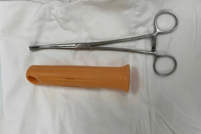 Nam thanh niên bị mắc kẹt cán cây lau nhà 15cm trong hậu môn