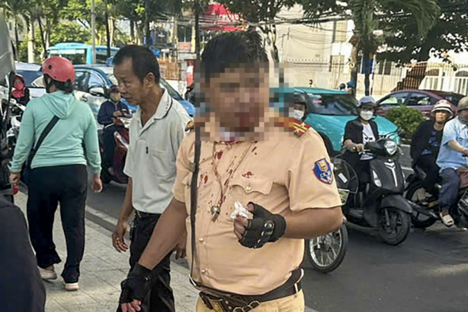 Trung tá CSGT bị người nước ngoài đấm vào mặt khi đang làm nhiệm vụ