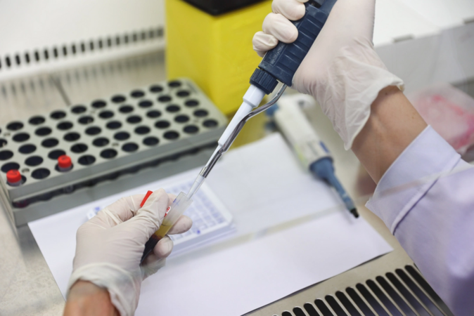 Kẻ thù giấu mặt của phong độ đàn ông