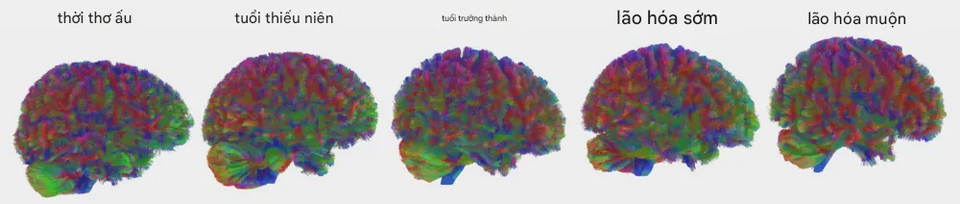 9 tuổi, 32 tuổi, 66 tuổi, 83 tuổi: bốn bước ngoặt của bộ não con người!