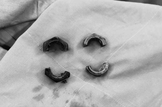 Cắt hai đai ốc để cứu "của quý": Cái giá của khoảng trống kiến thức