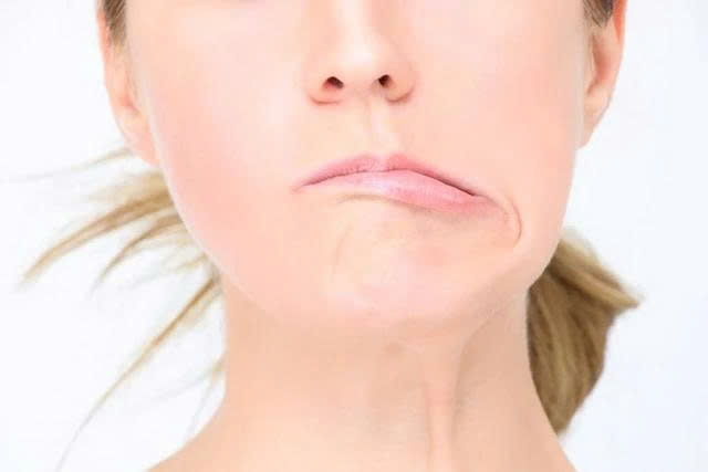 Một thói quen mùa hè có thể khiến nhiều người bị lệch mặt