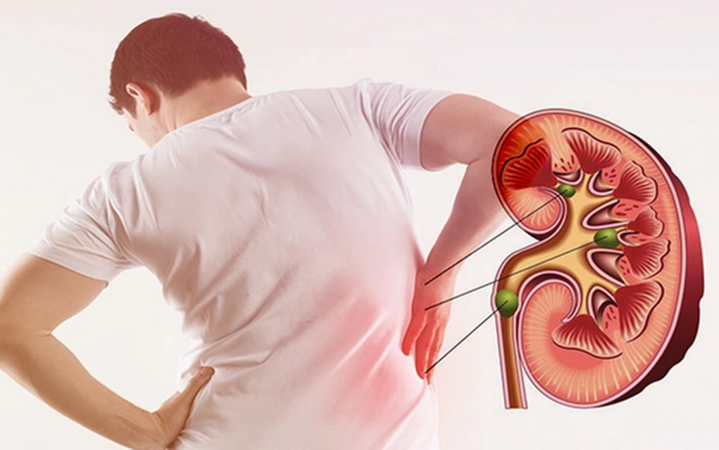 Nhiều người mất thận chỉ vì một thói quen khi đi tiểu mà ai cũng từng mắc phải