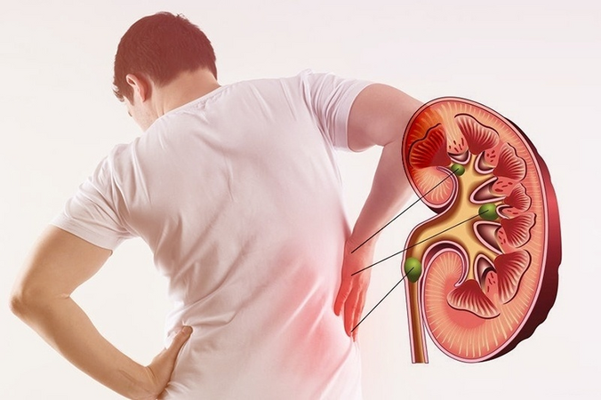5 dấu hiệu bất thường trong nước tiểu cảnh báo tổn thương thận sớm