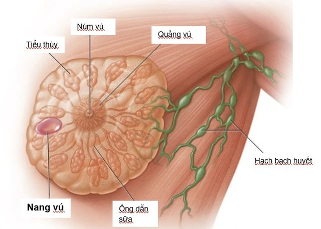 Tỷ lệ mắc và tử vong do ung thư tại Việt Nam ở mức cao
