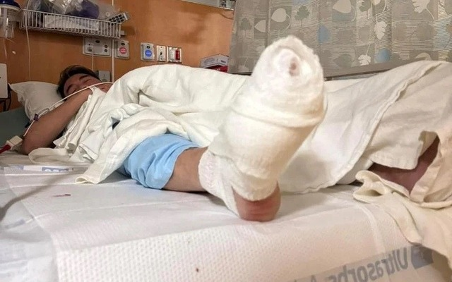 Đàm Vĩnh Hưng nói gì sau khi ca sĩ Bích Tuyền hé lộ chi tiết sốc vụ tai nạn khiến nam ca sĩ mất vài ngón chân?